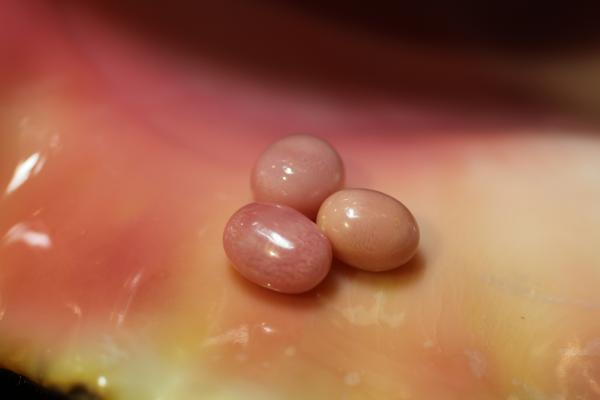 Fine Conch Pearls